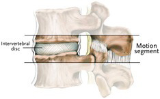back_pain_microsurgery